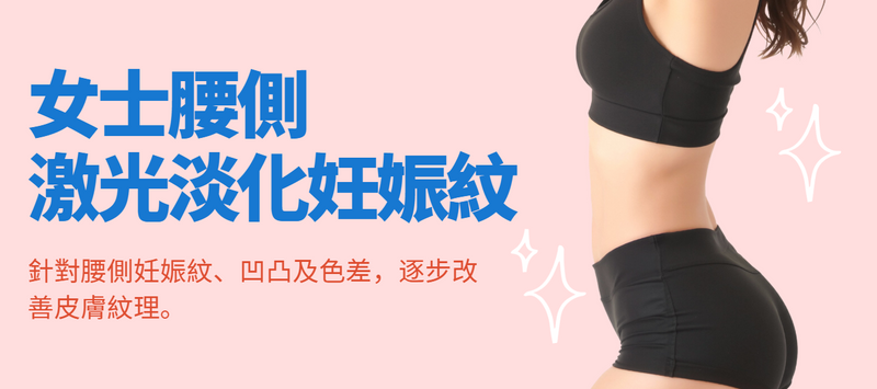 【女士腰側】激光淡化妊娠紋