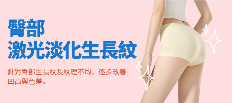 【臀部】激光淡化生長紋