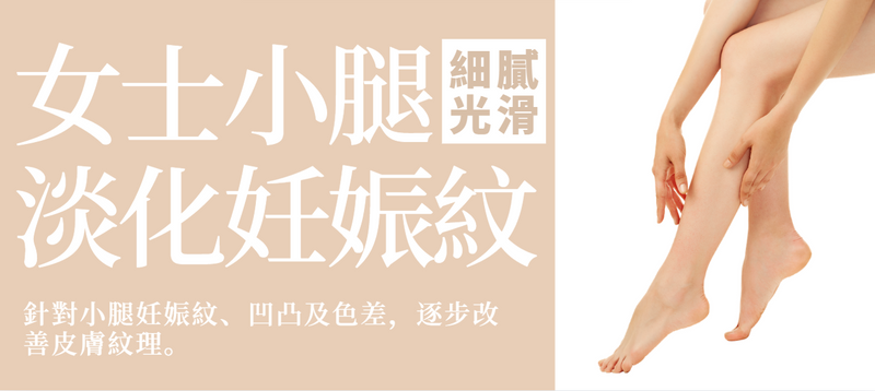 【女士小腿】激光淡化妊娠紋