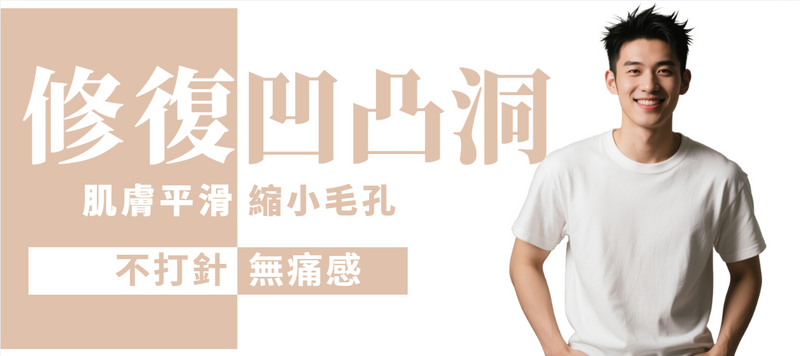 【全面】凹凸洞及粗大毛孔修復 (男士)